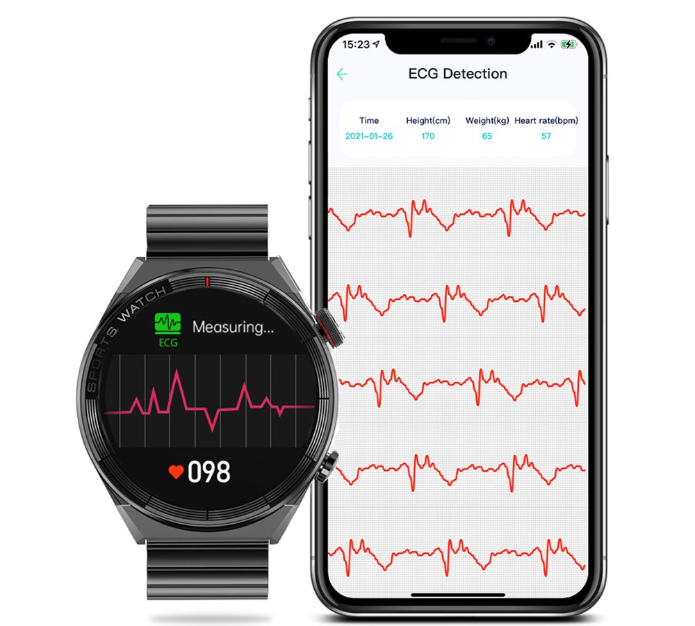 ekg